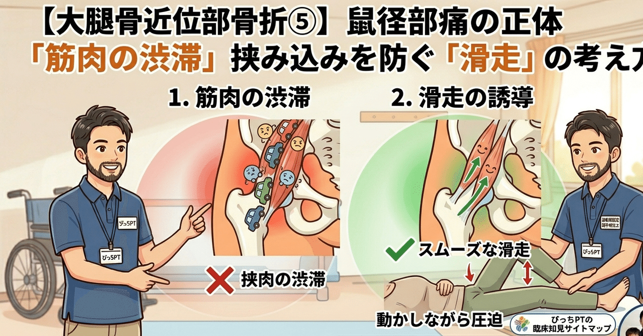 ⑤【大腿骨】鼠径部痛に悩んでない？「滑走」を知らなきゃ詰む理由