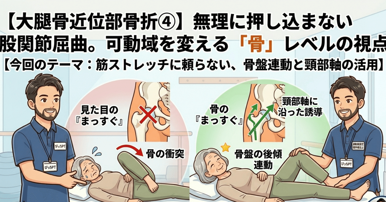 ④【大腿骨】屈曲ROM拡大はストレッチだけしてちゃ変わらない。「骨」レベルで見てみよう
