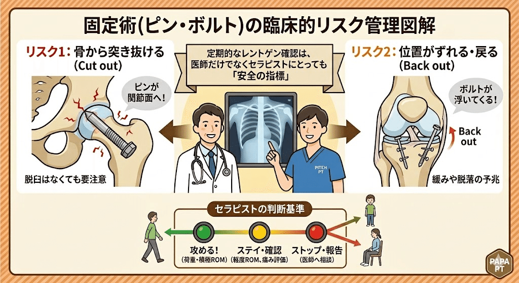 ①【大腿骨】なぜ超高齢でも手術するの?知らずにその後を考えると雲泥の差 本文図1
