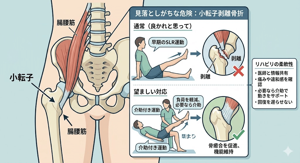 ①【大腿骨】なぜ超高齢でも手術するの?知らずにその後を考えると雲泥の差 本文図2