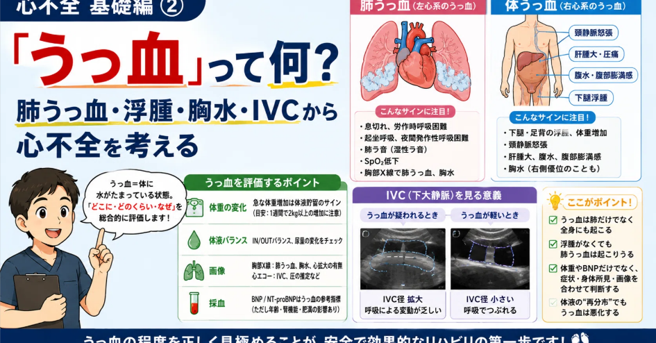心不全のうっ血・浮腫・胸水・IVC評価を解説する図解