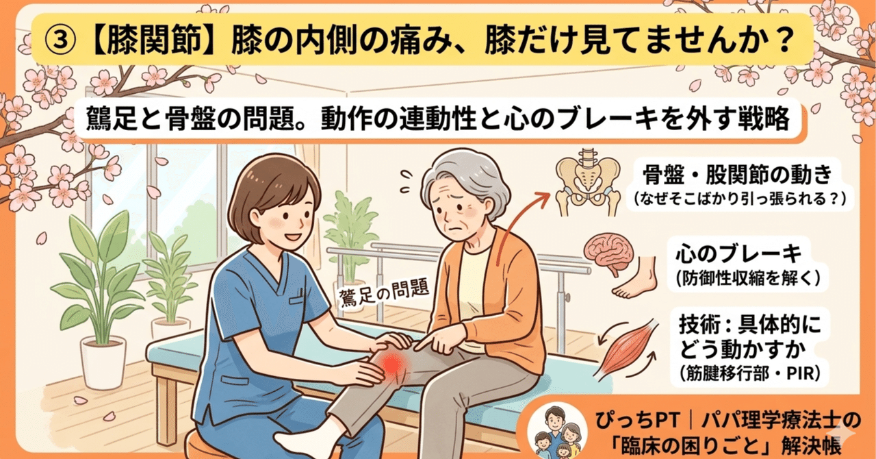 膝内側痛を鵞足と骨盤から考える