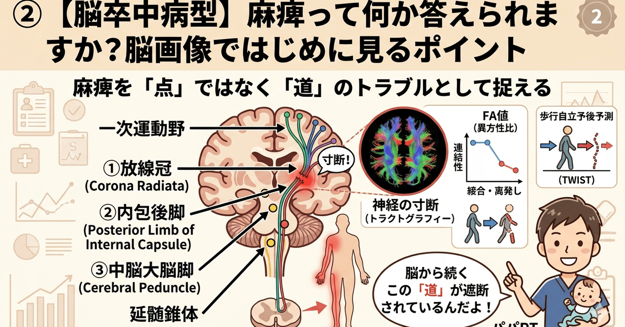 脳卒中の麻痺と皮質脊髄路を脳画像から考えるアイキャッチ画像